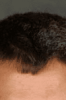 Profile photo of Kevin Bieksa